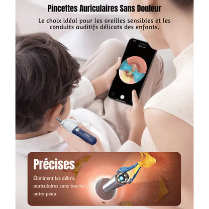 Bebird EarSight Plus Oorreiniger