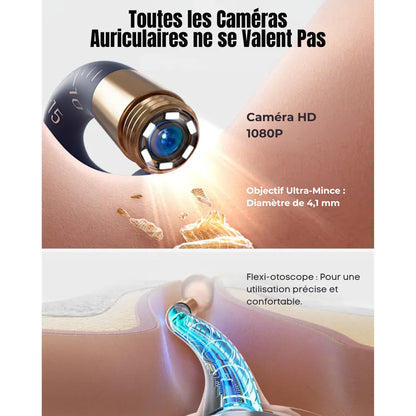 Bebird EarSight Plus Oorreiniger