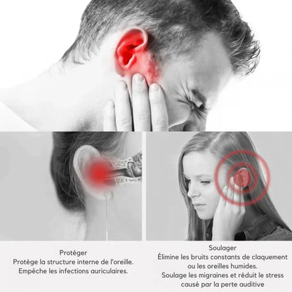 Bebird EarSight Plus Oorreiniger